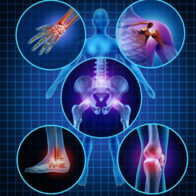 How Oxidation Leads to Oxidative Stress in Our Bodies